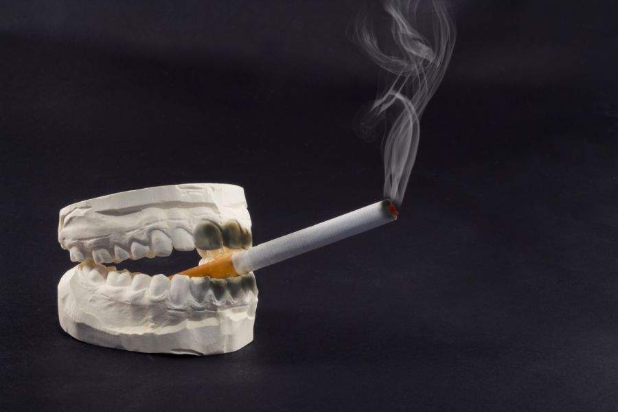 Smoking and Dental Implants Don’t Go