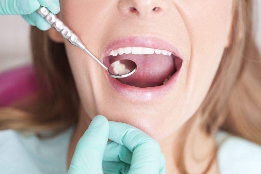 How Often Should You Go to the Dentist?