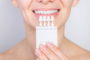 cosmetic veneers process townsville