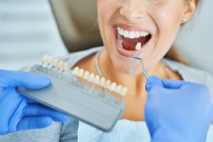 influencing factors getting veneers teeth townsville