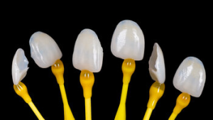 teeth whitening