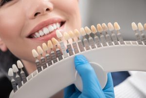 veneer functionality dentist clinic townsville
