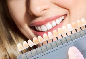 veneers treatment financing options townsville casey dentists