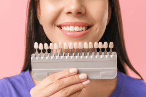 chipped teeth queensland