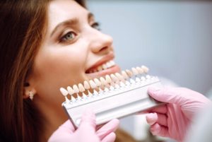 veneers vs crowns colour