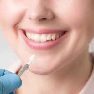 are veneers permanent procedure