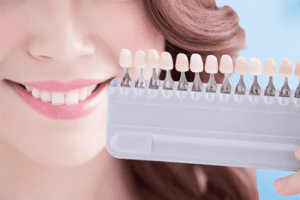 dental veneer procedure aitkenvale