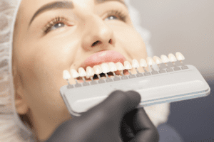 dental veneers Aitkenvale