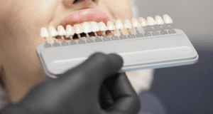 BRISBANE dental implants 