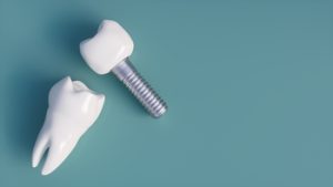 implant dentist for seniors townsville