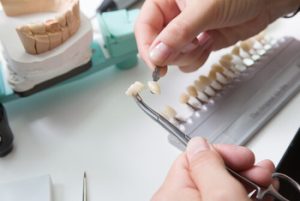 Are Veneers Bad For Your Teeth shells townsville