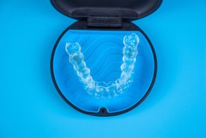 Invisalign Vs veneers orthodontic aligners