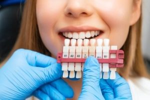 Teeth Whitening Bali colour