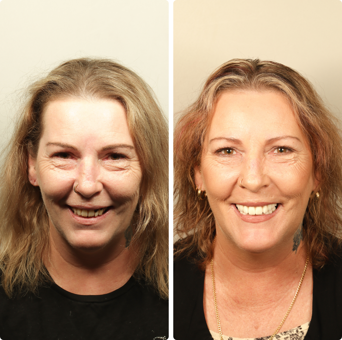 before-after