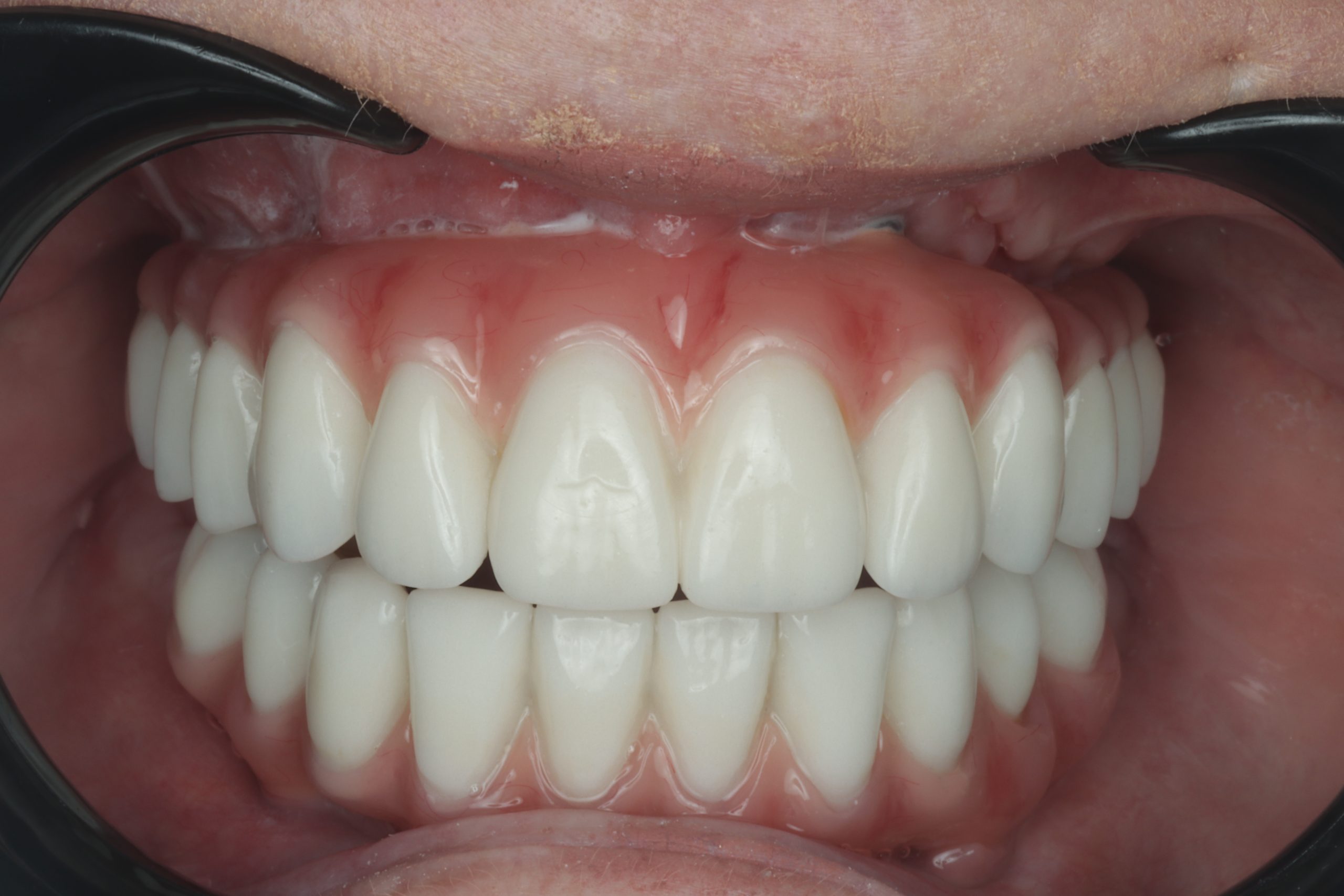 procedure