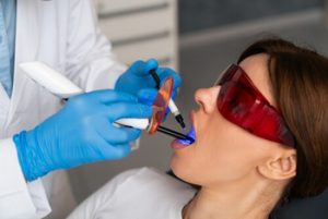 How to Whiten Fillings on Front Teeth whitening