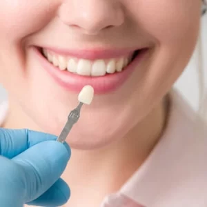 Can You Whiten Porcelain Veneers use