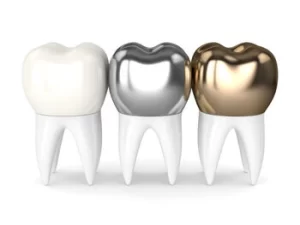 symptoms of loose dental implant crown types